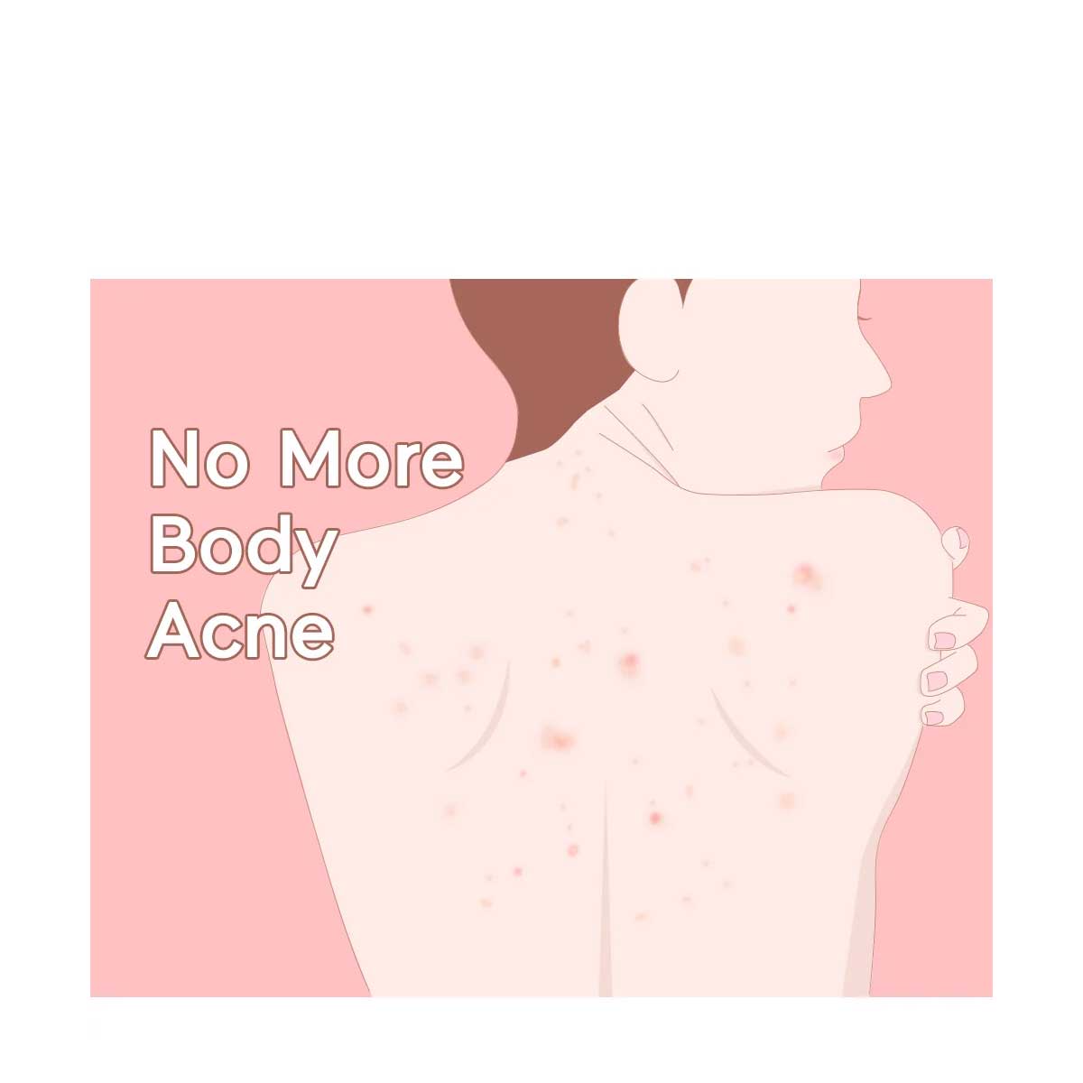 Tiam Anti-Blemish Body Lotion 200ml - Image 7