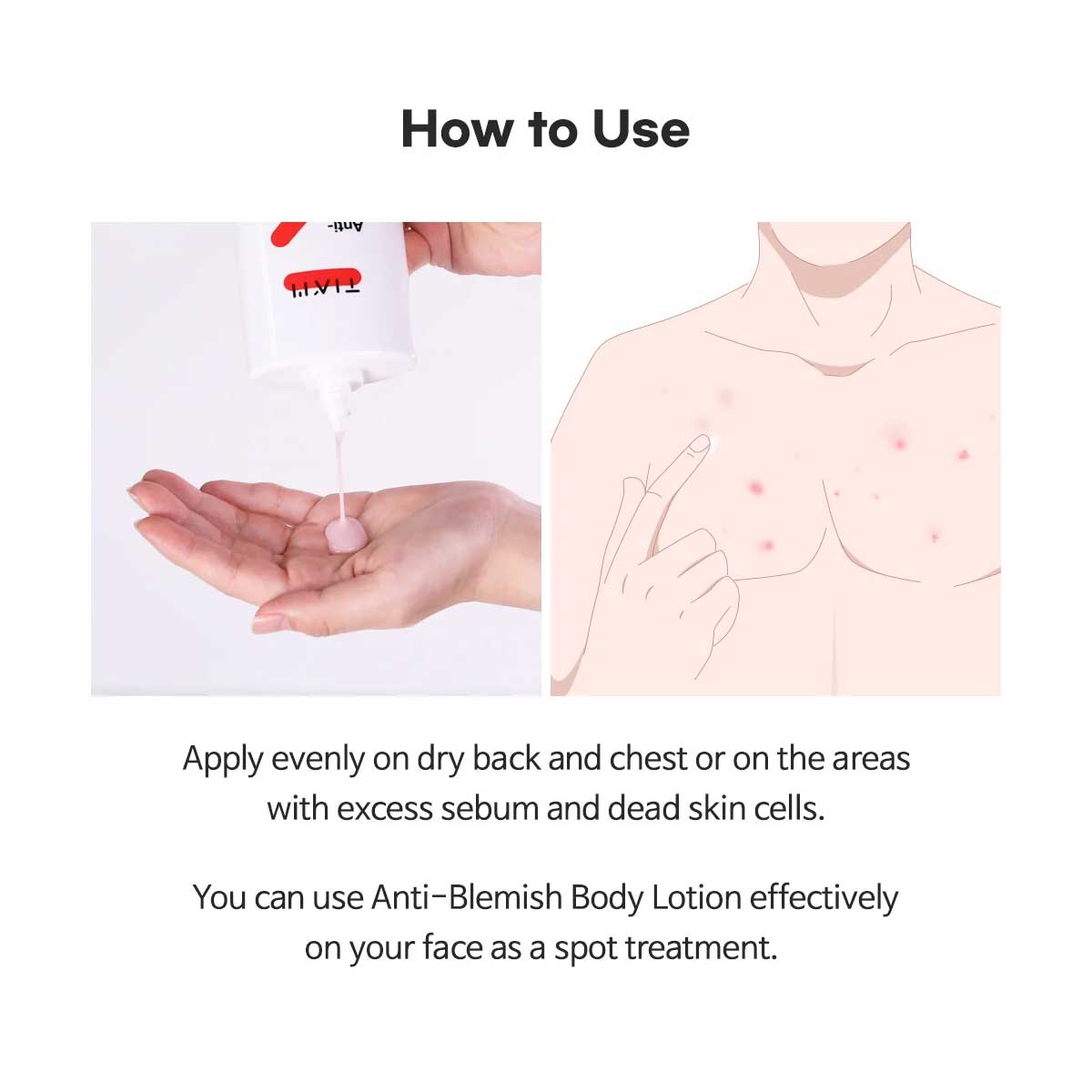 Tiam Anti-Blemish Body Lotion 200ml - Image 3